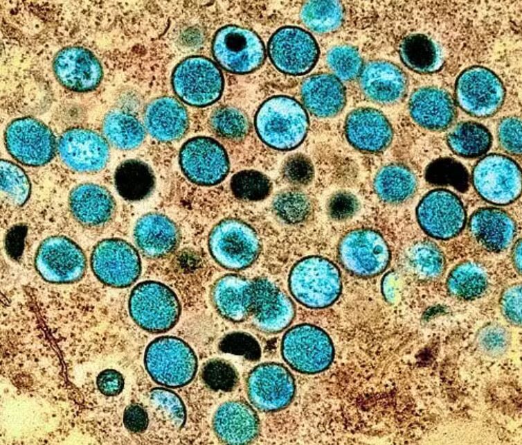 Первый подтвержденный случай обезьяньей оспы в Таиланде